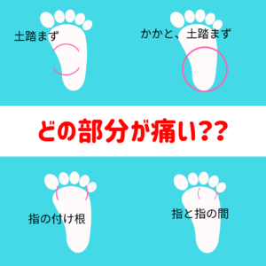 あなたの足裏の痛みの原因はどれでしょう？