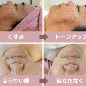 オーガニックエステ「１回」で…（モニター様50代、40代）